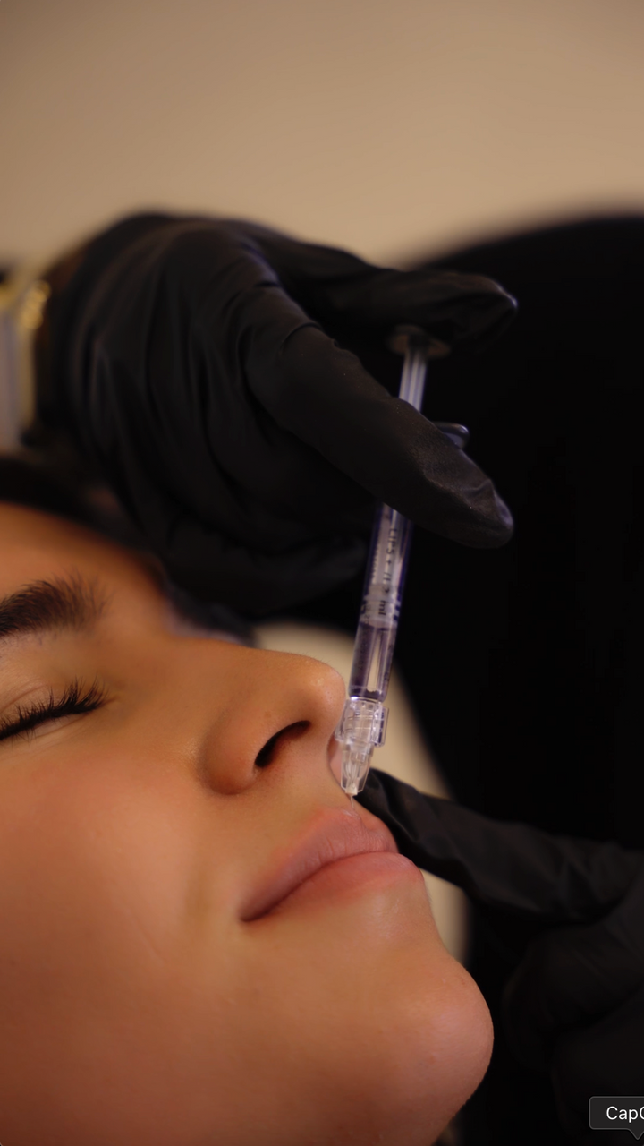 Half Syringe Lips + 40 units Tox